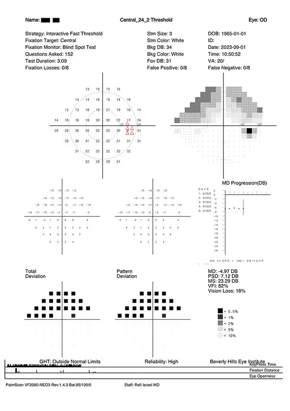 Sample-Test-VF2000-24-2-1 (1)