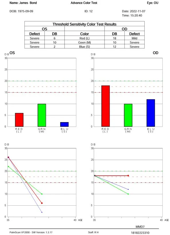 VF2000-Virtual-Reality-visual-field-Advanced-Color-Test
