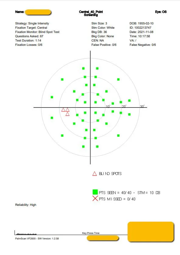 VF2000-Virtual-Reality-visual-field-Blind-Spot-Test-Single-Intensity