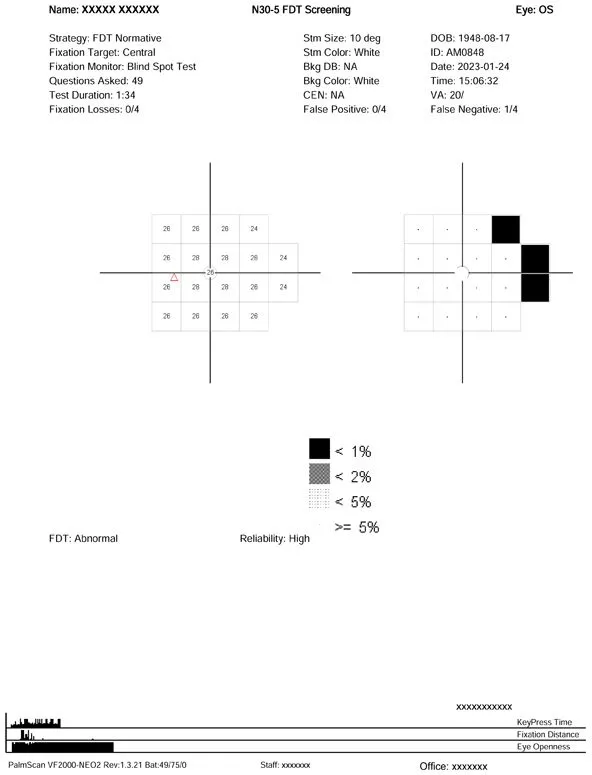 VF2000-Virtual-Reality-visual-field-FDT-Screening
