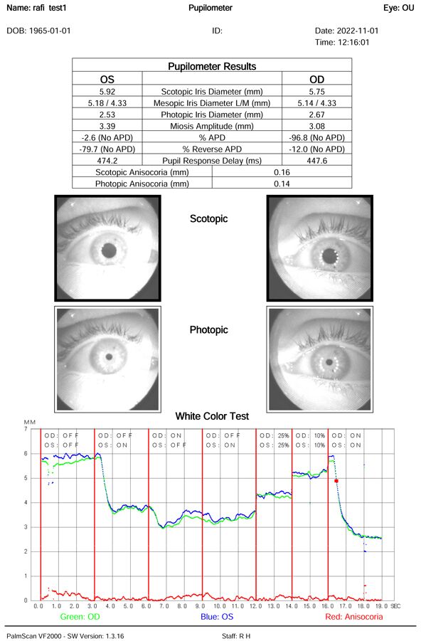 VF2000-Virtual-Reality-visual-field-Pupilometer